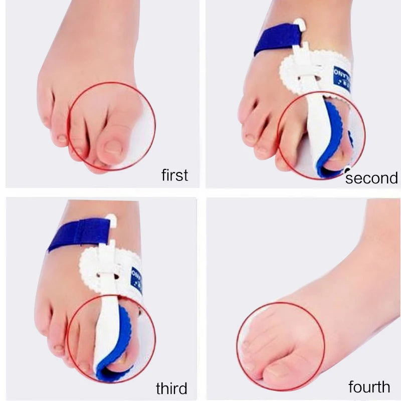 Bunion Splint Straightener Big Toe Corrector Foot Pain Relief Hallux Valgus Correction Orthopedic Bone Thumb Foot Care Tools