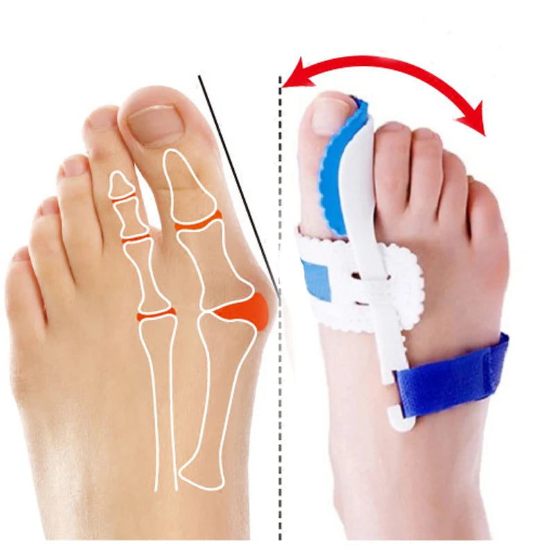 Bunion Splint Straightener Big Toe Corrector Foot Pain Relief Hallux Valgus Correction Orthopedic Bone Thumb Foot Care Tools